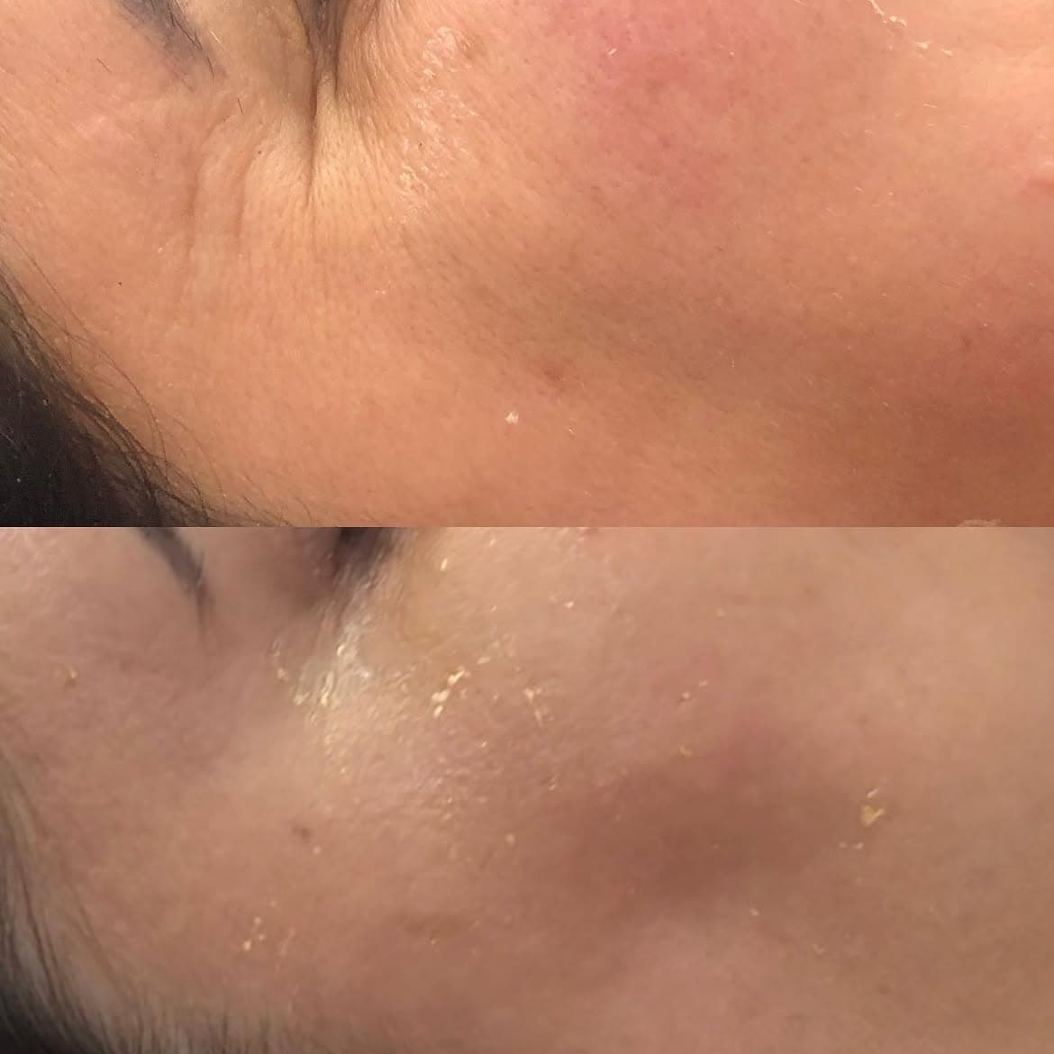 Resultado de tratamento — antes e depois