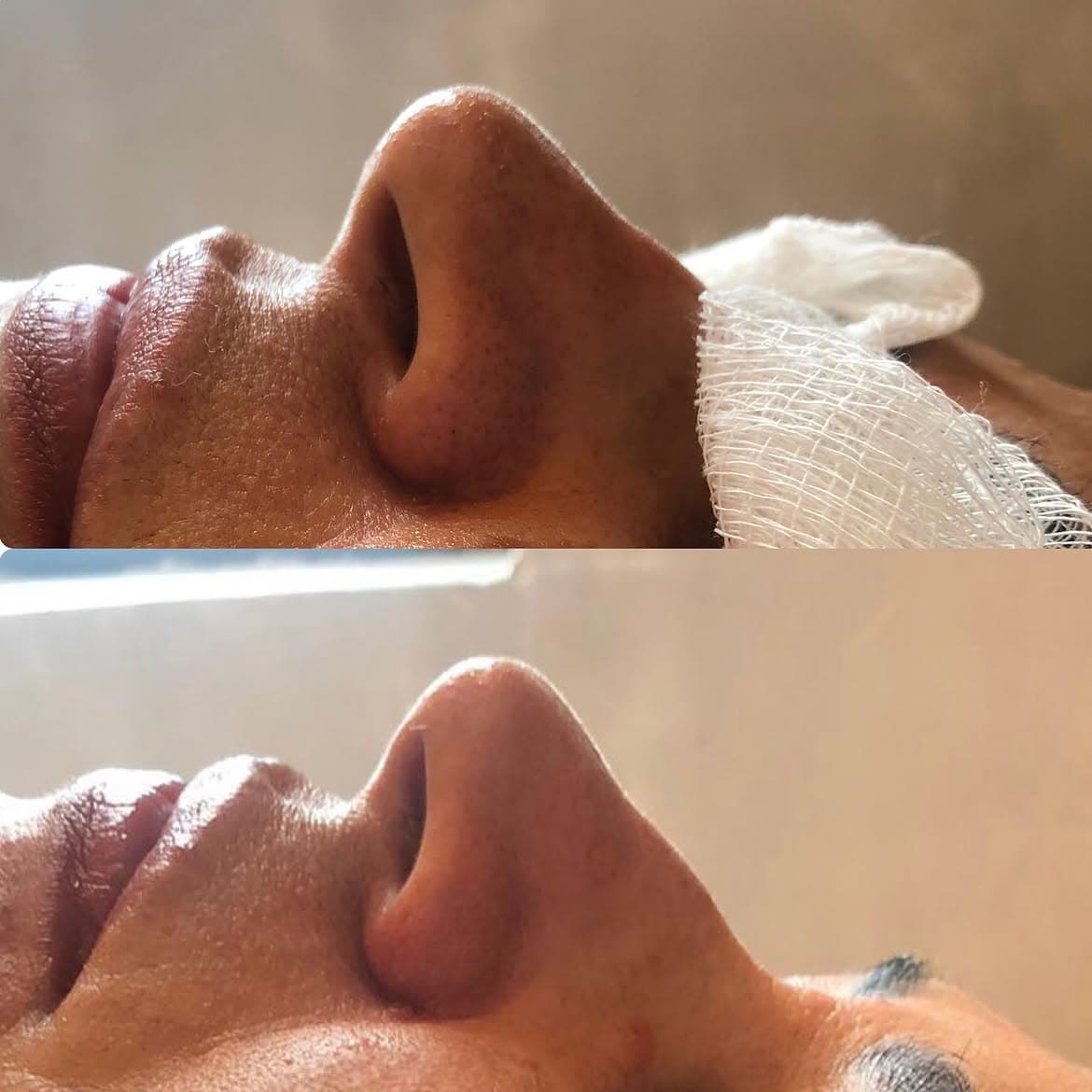 Resultado de tratamento — antes e depois